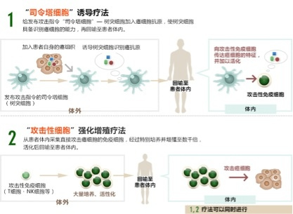 日本免疫细胞,细数日本免疫细胞疗法