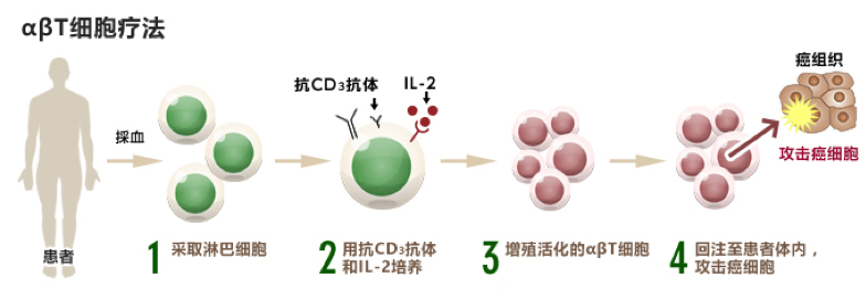 日本免疫细胞,细数日本免疫细胞疗法