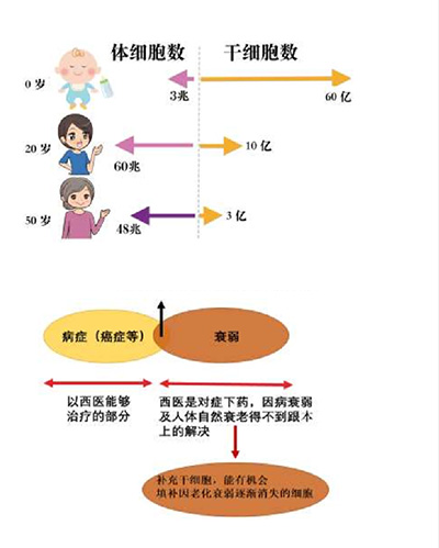 日本干细胞,日本先端医疗干细胞疗法