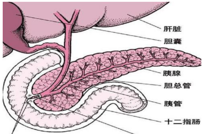 胰腺癌常“伪装”成胃病，身体若出现这8种状况，就要小心了！