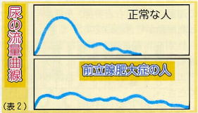 JMT独家 | 关于日本前列腺肥大治疗方法介绍