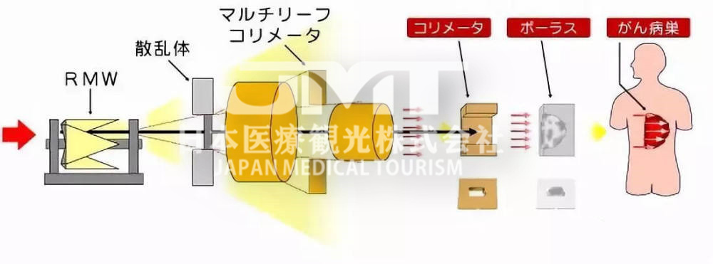 日本质子治疗的全方位解析