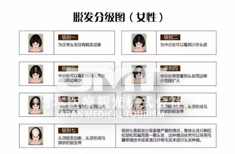 脱发、多毛、爆痘、很多女生中招却不知道是这个原因