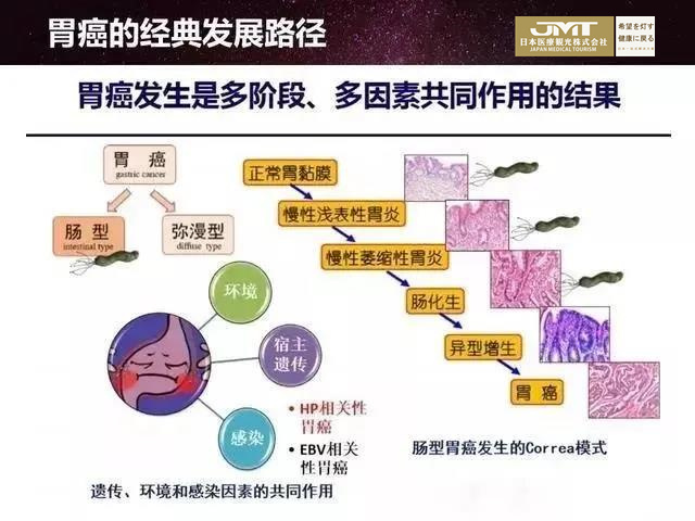 从胃炎到胃癌需要多久？胃镜有必要每年做吗？