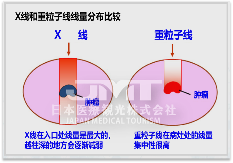 QST医院（放射线医学综合研究所）重离子治疗介绍