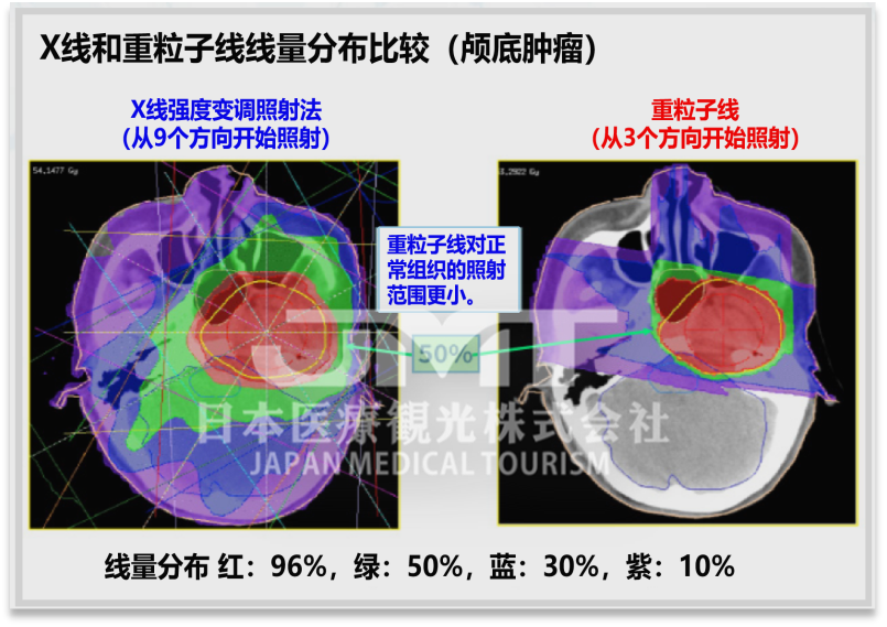 QST医院（放射线医学综合研究所）重离子治疗介绍