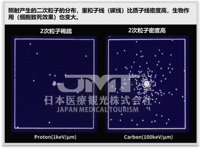 QST医院（放射线医学综合研究所）重离子治疗介绍