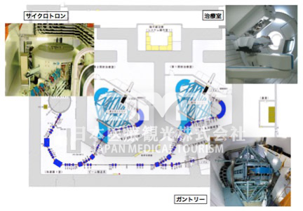日本国立癌症研究中心东医院质子治疗装置及特点介绍