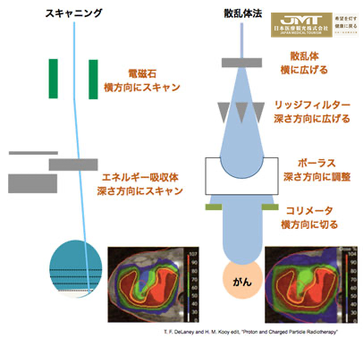 日本国立癌症研究中心东医院质子治疗装置及特点介绍