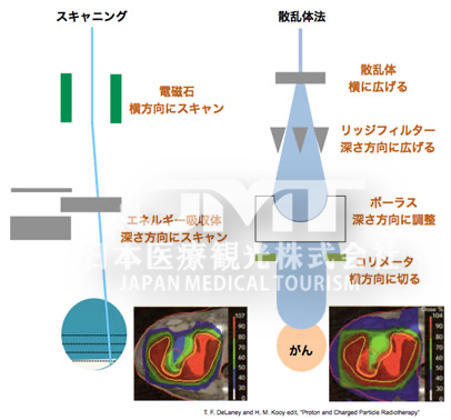 日本国立癌症研究中心质子治疗全方位解析