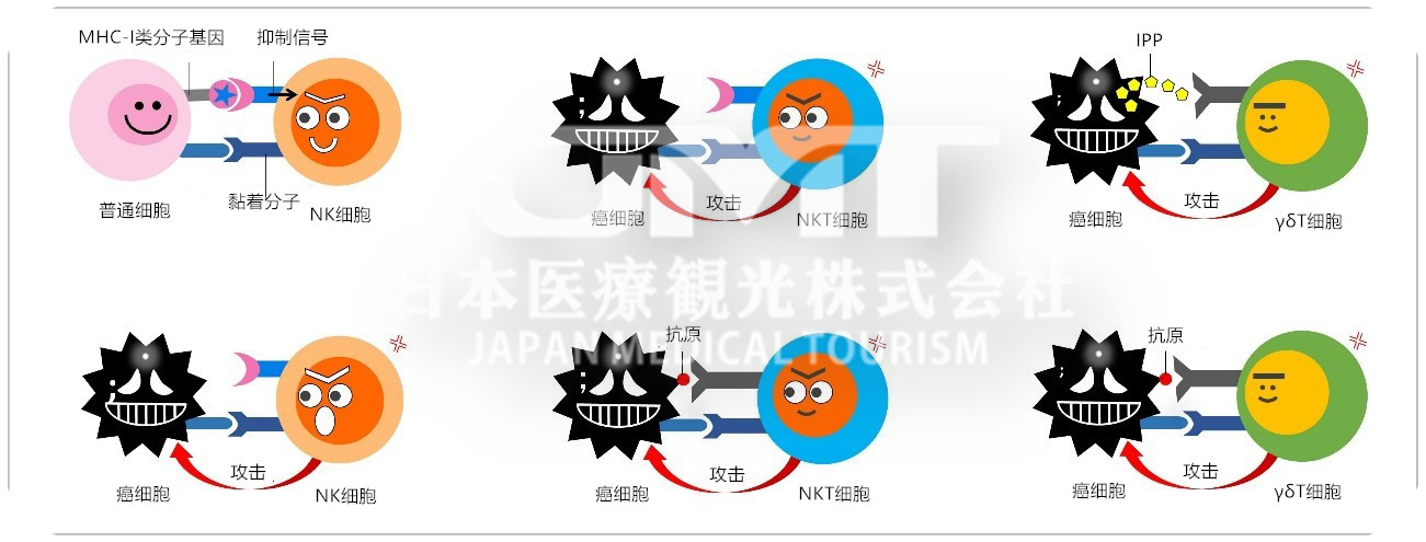 日本免疫细胞疗法及具体原理内容是什么？