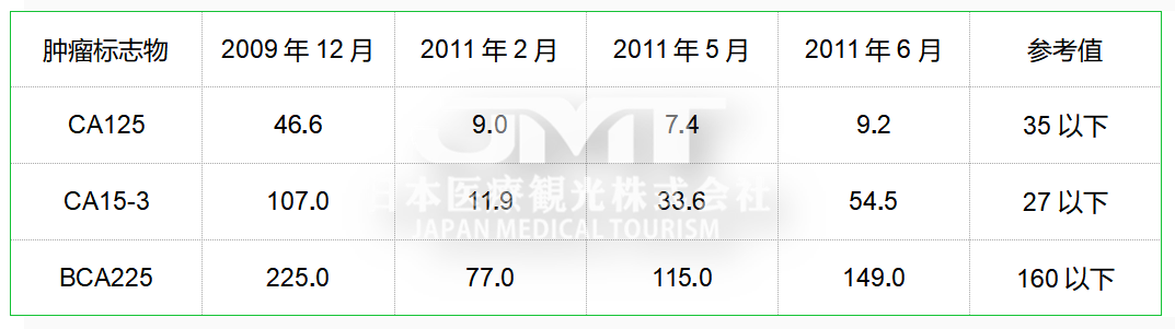 日本针对乳腺癌的免疫细胞治疗方法解析