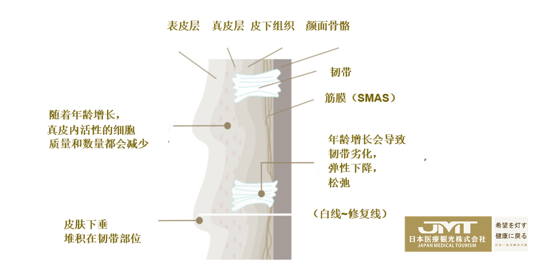 日本干细胞-就这么简单真的可以吗？！【松弛治疗】最前线