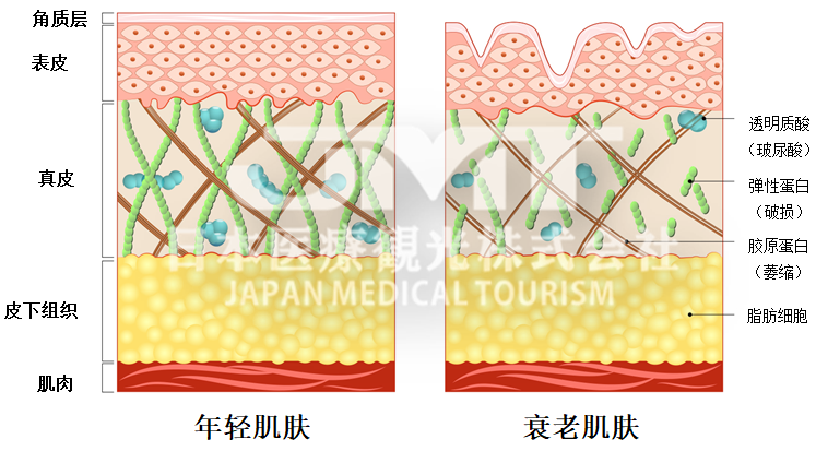 JMT日本干细胞-抗衰的决定性一击？逆转肌肤时光的肌肤再生医疗