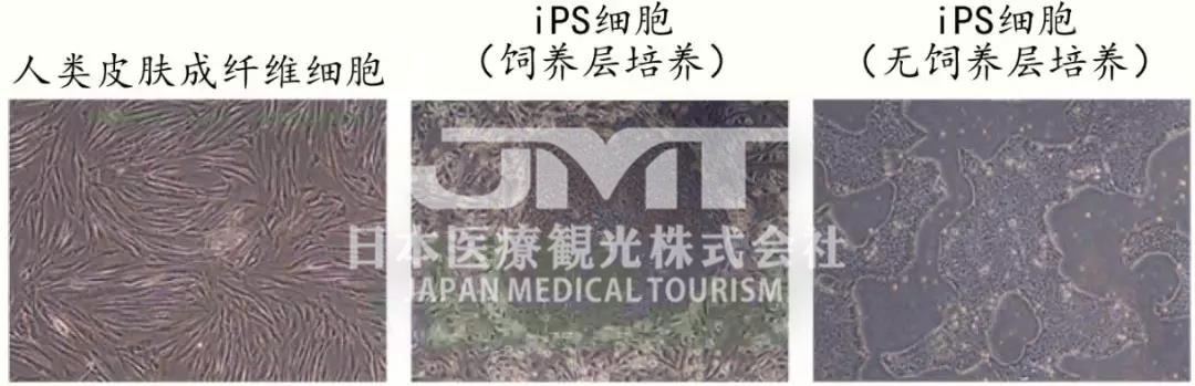 日本发现iPS细胞对受损DNA的修复保护机制