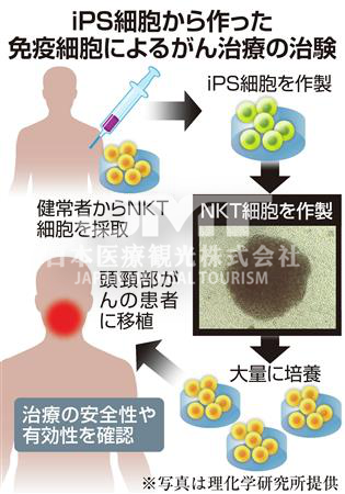 iPS癌症治疗--千叶大学等利用免疫细胞国内首次实施移植