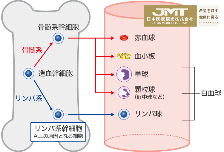 JMT日本尖端医疗-日本研究小组发现急性成淋巴细胞性白血病的弱点