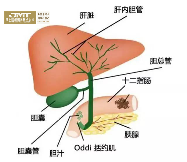 JMT日本癌症治疗-日本胆管癌治疗深度解析