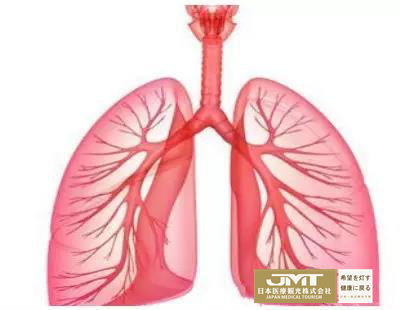 JMT日本重离子治疗-深度剖析日本呼吸系统疾患的重离子疗法