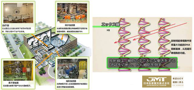 JMT日本重离子治疗-深度剖析日本呼吸系统疾患的重离子疗法