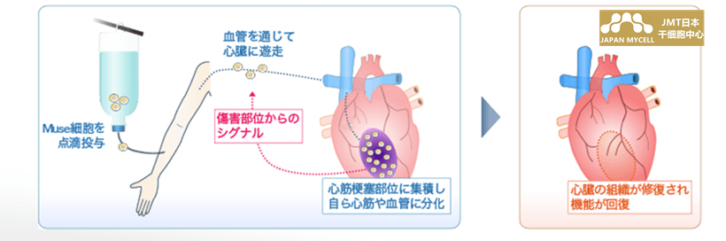 JMT日本干细胞-什么是Muse细胞？对急性心肌梗死、脑梗死、脊髓损伤、大疱性表皮松解症患者的临床试验也进行解释说明！