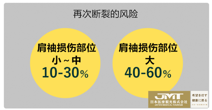 JMT日本干细胞-针对肩部疼痛的日本干细胞治疗