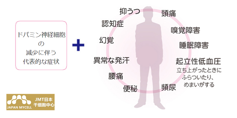 JMT日本干细胞治疗帕金森-帕金森病的症状、诊断、和治疗