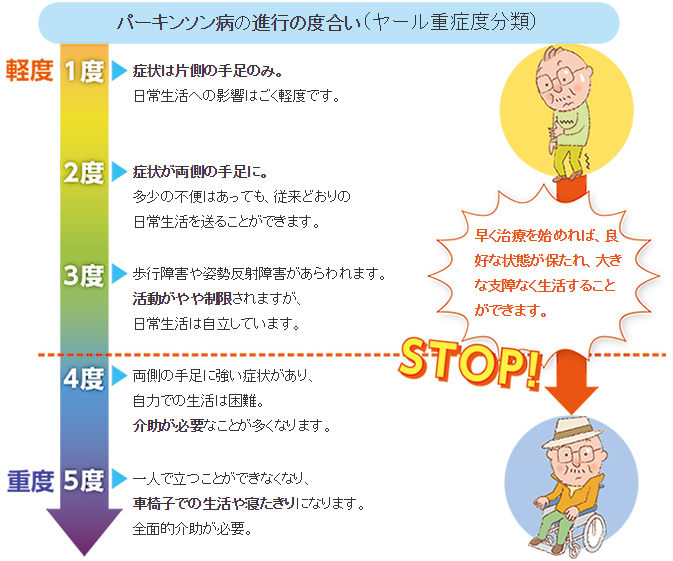 JMT日本干细胞治疗帕金森-帕金森病的症状、诊断、和治疗