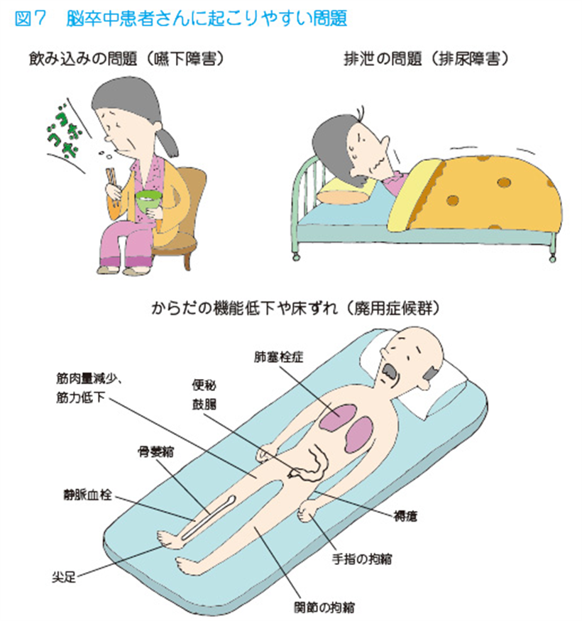 JMT日本干细胞-脑梗脑中风脑出血干细胞及其他治疗方法