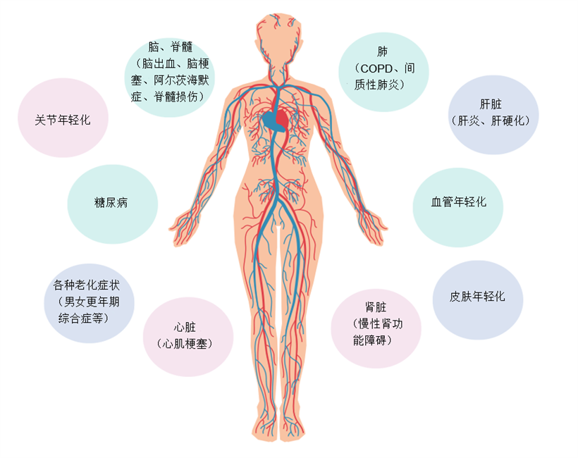 JMT日本干细胞-脑梗脑中风脑出血干细胞及其他治疗方法