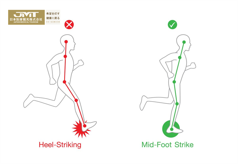 JMT日本医疗-应选择正确的跑步方式防止跑步引起膝盖痛