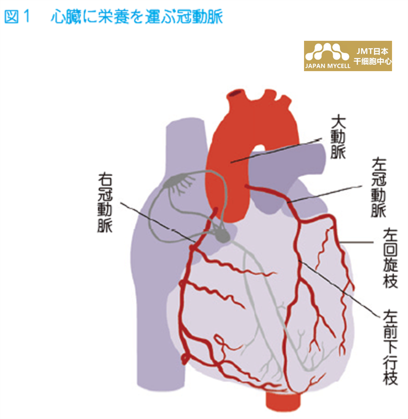 JMT日本干细胞-心肌梗塞的干细胞治疗