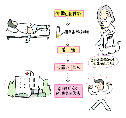 JMT日本干细胞-心脑血管心脏病的干细胞治疗说明