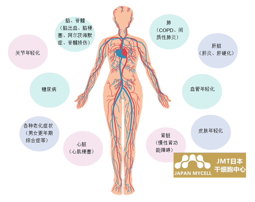 JMT日本干细胞-心脑血管心脏病的干细胞治疗说明