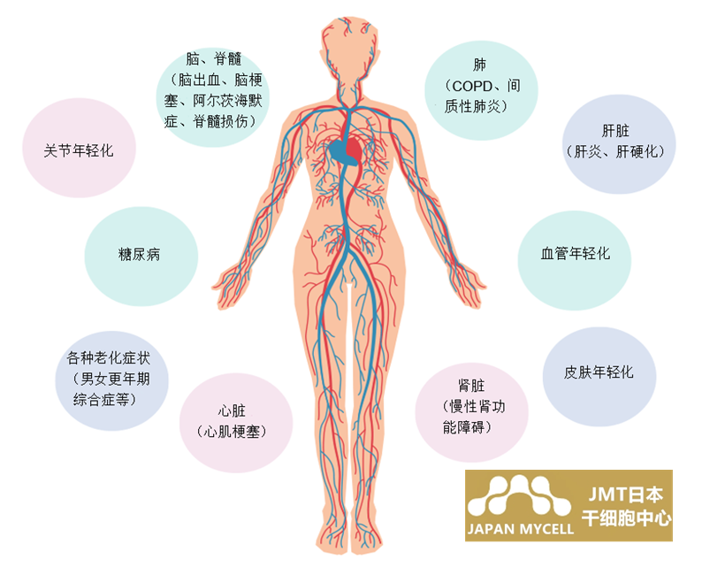 JMT日本干细胞-心脑血管疾病的干细胞治疗