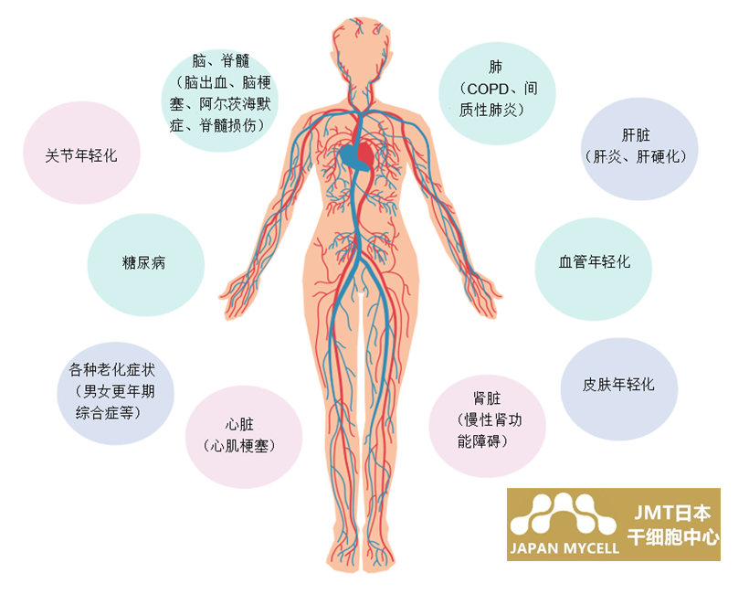 JMT日本干细胞-心脑血管干细胞治疗的现状