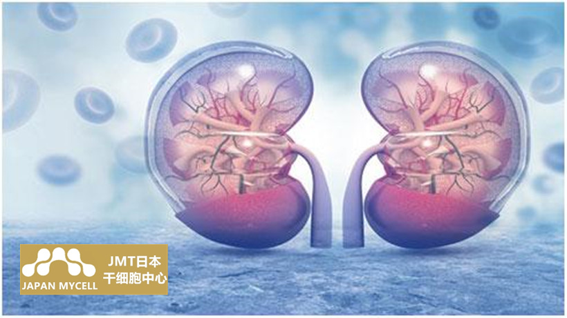 JMT日本干细胞-肝硬化肾衰竭的常规治疗