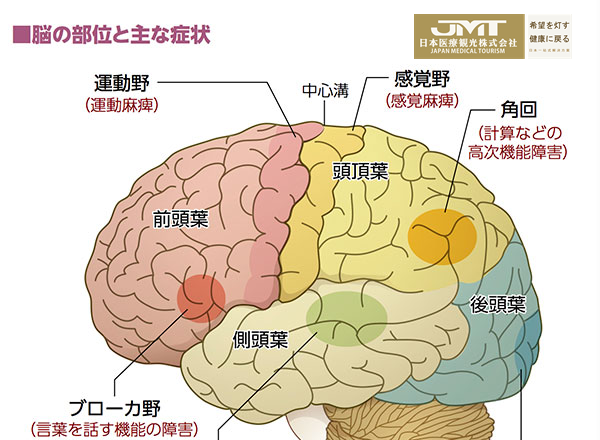 JMT日本看病-视野欠缺是脑膜瘤的征兆？听力下降也是！