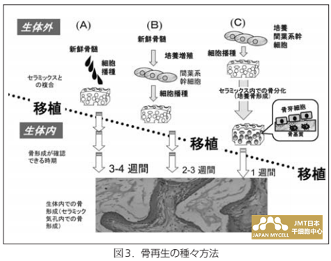 JMT日本干细胞-骨再生医疗③