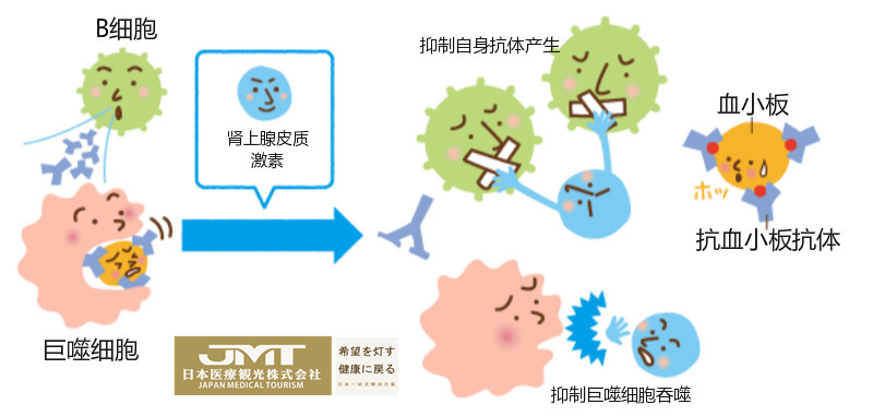 JMT日本医疗-原发免疫性血小板减少症（ITP）的日本治疗