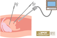 JMT日本医疗-原发免疫性血小板减少症（ITP）的日本治疗