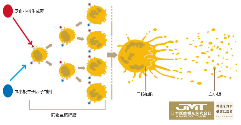 JMT日本医疗-原发免疫性血小板减少症（ITP）的日本治疗