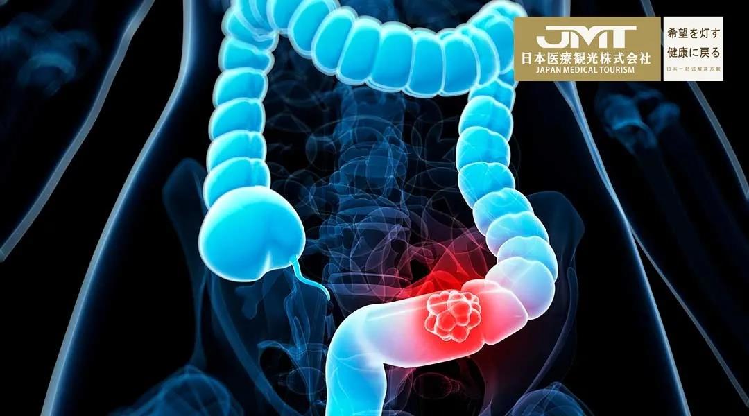 JMT日本医疗-痔疮、肛周脓肿是否有发展成直肠癌的风险
