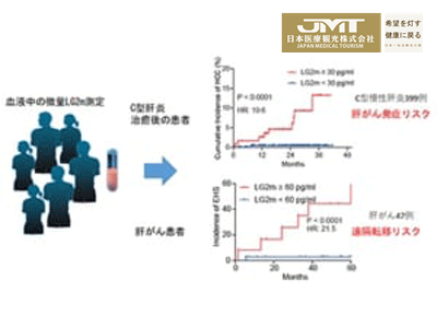 JMT日本医疗-日本大学成功鉴定与肝癌，发病和转移有关的血液标志物LG2m