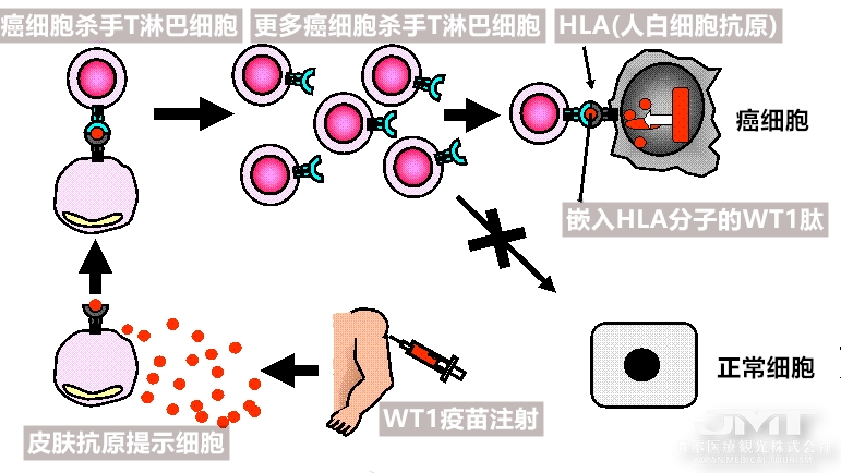 JMT日本医疗-您听说过吗？癌症也能打疫苗