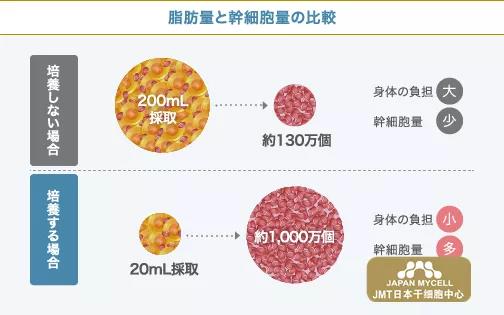 JMT日本干细胞-日本人如何治疗变形性膝关节症