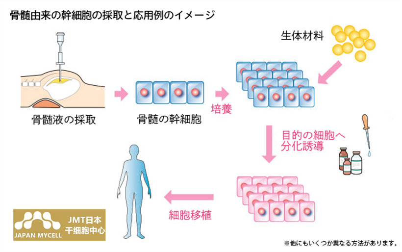 JMT日本干细胞-日本再生医疗干细胞