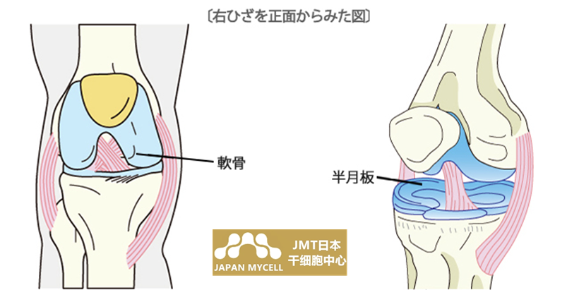 JMT日本干细胞-膝盖手肘肩腰关节的干细胞治疗