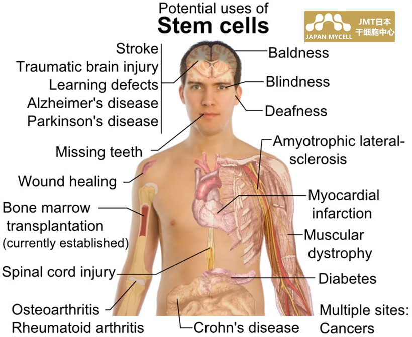 JMT日本干细胞-你了解干细胞吗？