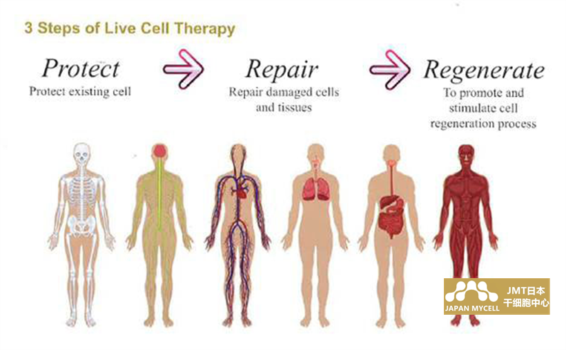 JMT日本干细胞-细胞疗法科普